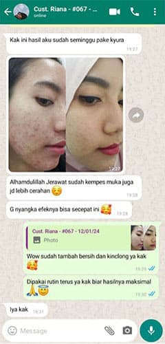 landing-page-testi-wa-05a
